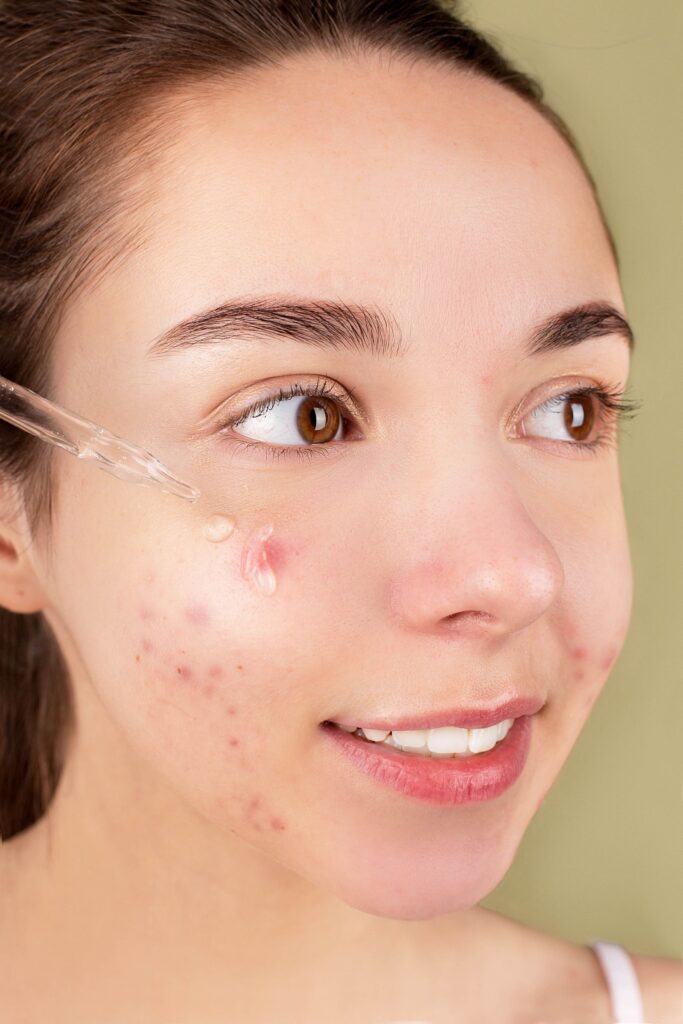 Jeune femme appliquant un sérum sur son visage lors de sa routine de soin